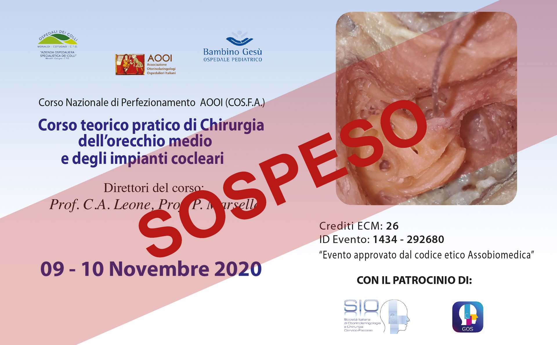 corso-tericopratico-impianto-cocleare-sospeso